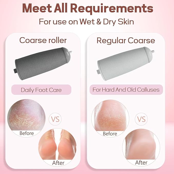 REMOVEDOR DE CALLO ELÉCTRICO